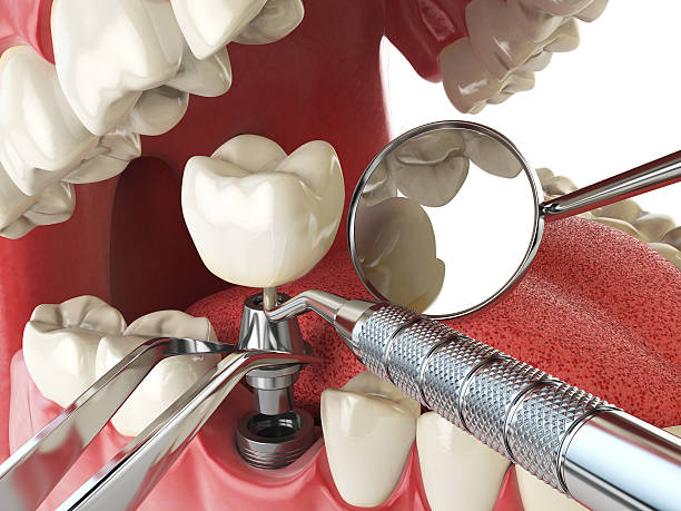 Professional Emergency Dental Service in TX